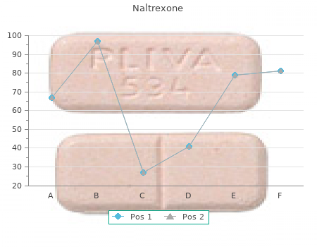 order 50 mg naltrexone with visa